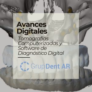 Herramientas 3D para odontología