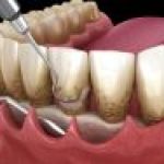 PERIODONCIA PERIODONCIA