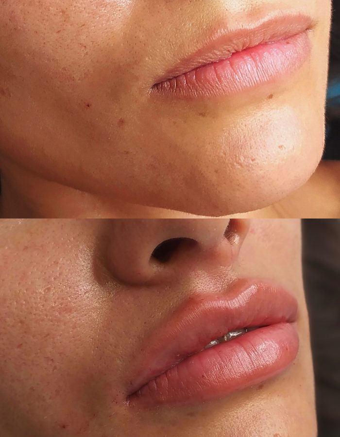 Russian Lips